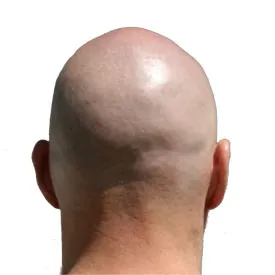 publive-image