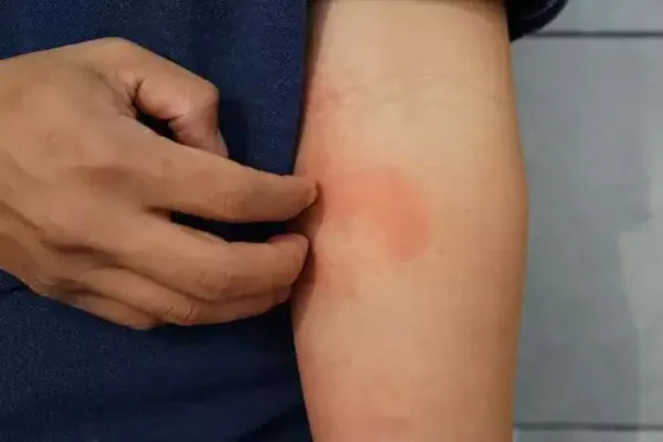 publive-image