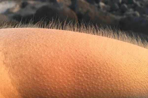 publive-image