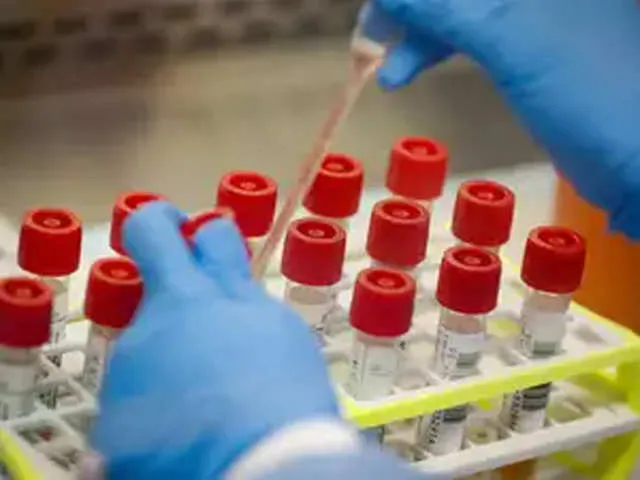 Chinese company sold sub-standard test kits: Spain, Czech - The ...
