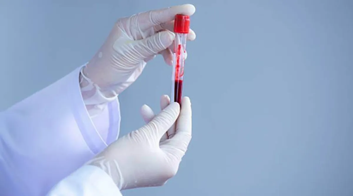 65 patients part of multi-centre clinical trial to test plasma ...