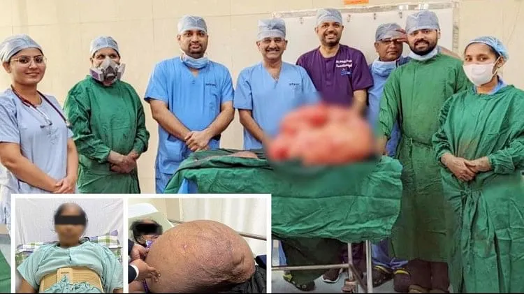 Gujarat: Doctors give new life to 56-year-old woman in Ahmedabad, 47 kg tumor removed from stomach – PressWire18