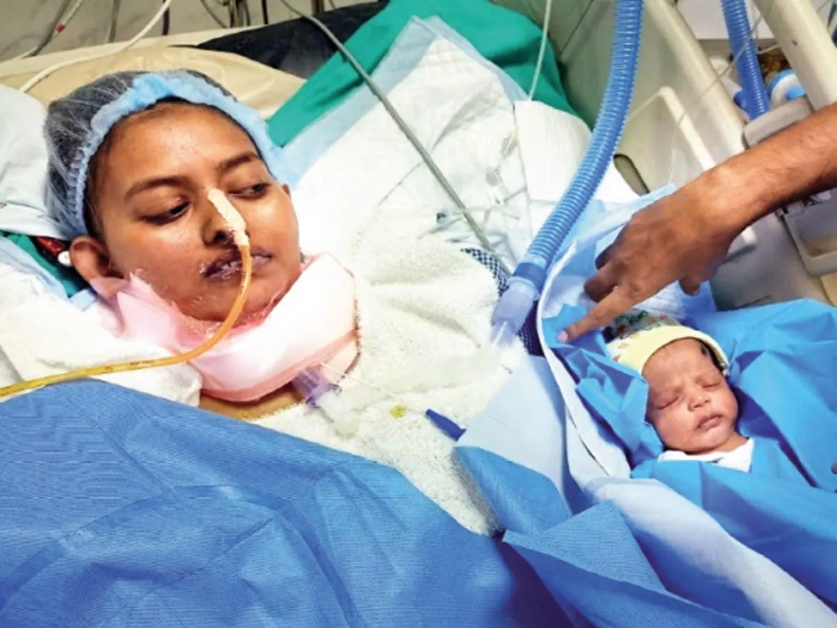Yogi Adityanath govt sanctions Rs 1.5 crore for lung transplant of Covid-hit Lucknow medico | Lucknow News - Times of India