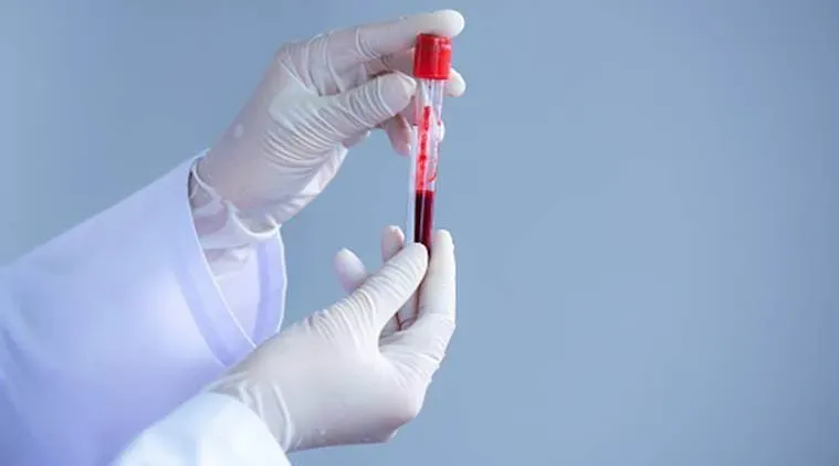 65 patients part of multi-centre clinical trial to test plasma ...