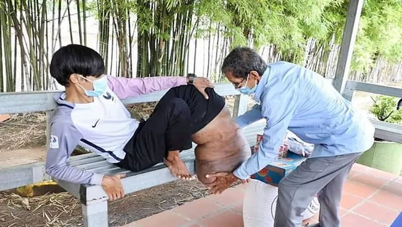 
<p>बोंग ने कहा कि पहले ये एक छोटा सा घांव था। उनके माता-पिता ने भी इसे नजरअंदाज कर दिया क्योंकि उन्हें लगा कि ये नॉर्मल सी खरोंच है। लेकिन  धीरे-धीरे ये ट्यूमर में बदल गया। </p></p>
<p> 