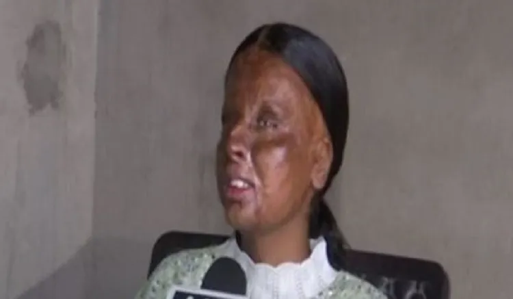 Acid attack survivor, a peon's daughter, tops in school with 95 per cent in CBSE Class 10 exams - Dynamite News