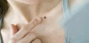 publive-image