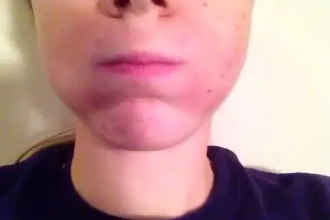 publive-image