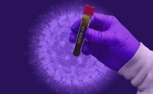 publive-image