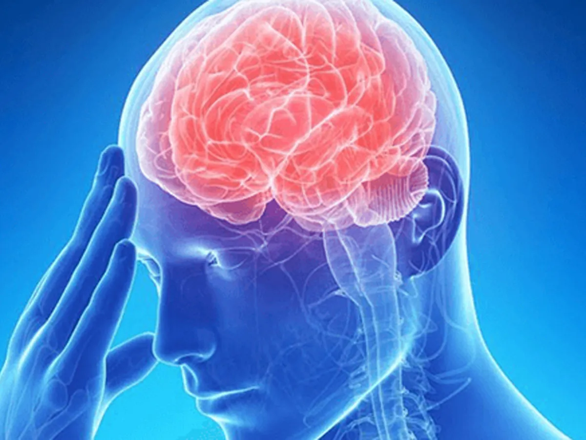 stroke symptoms-2