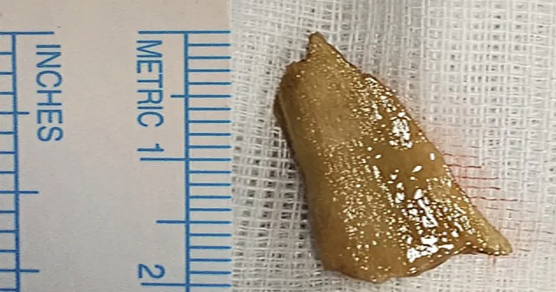 swasakosham