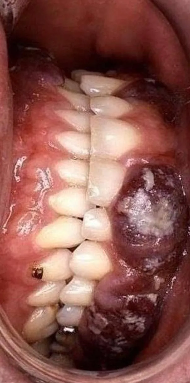 drugs 333