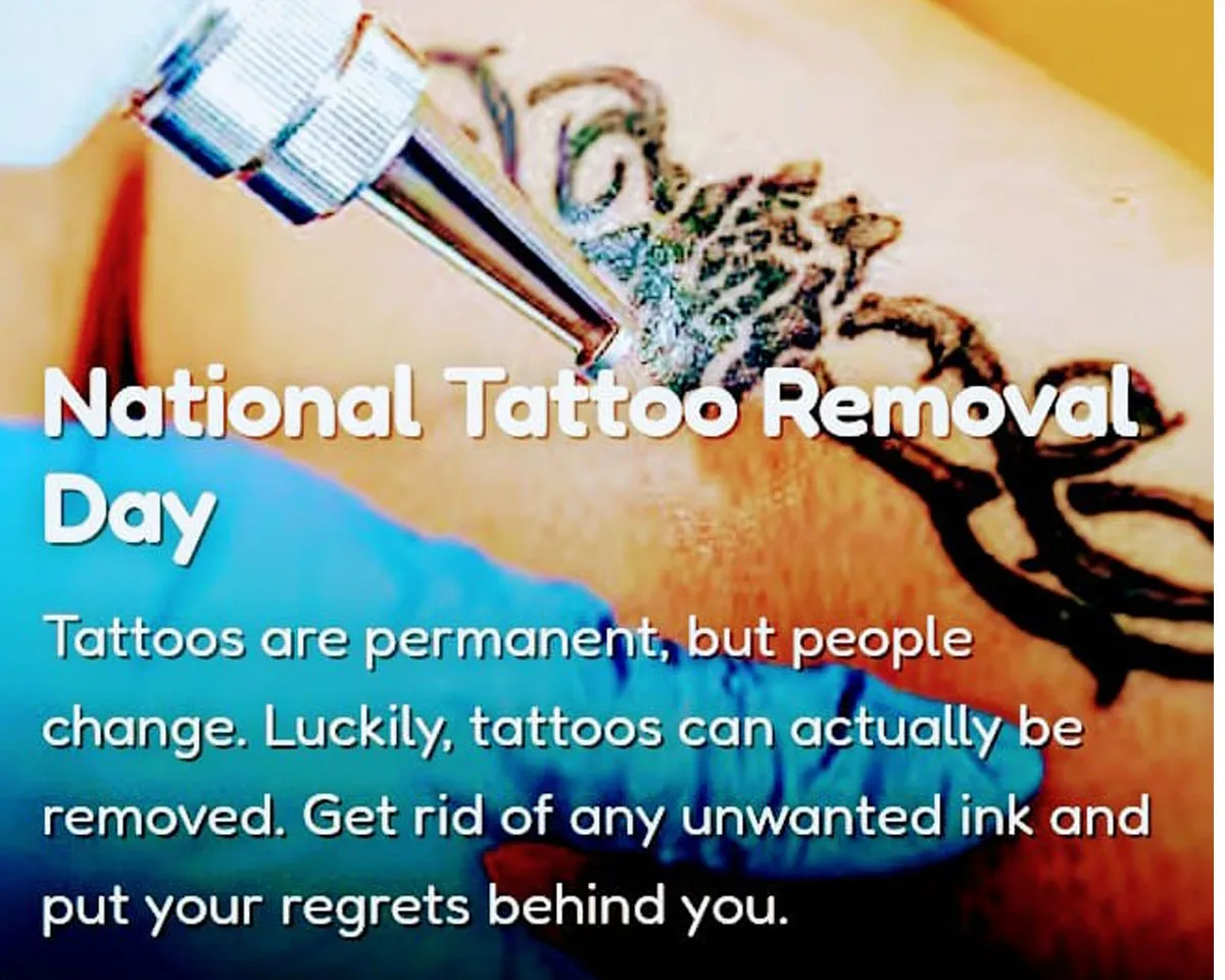 tatoo removal