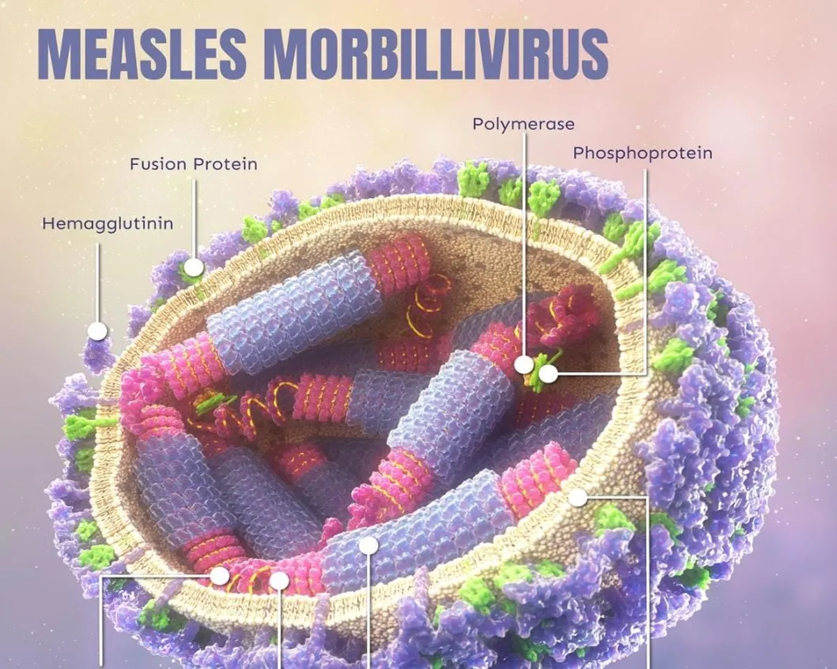 Measles-2