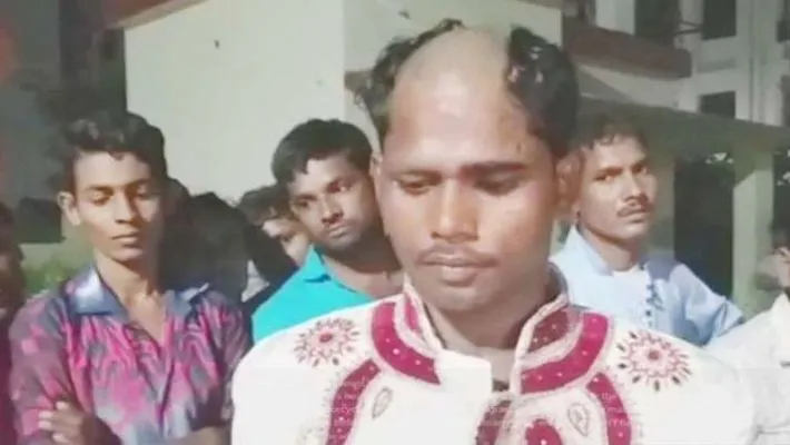 Groom's head tonsured allegedly because he refused to marry the bride