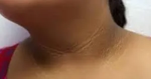 publive-image