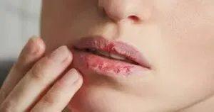 publive-image