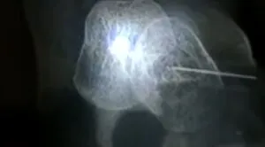 publive-image