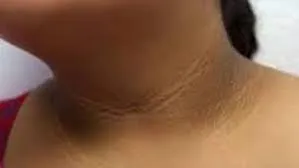 publive-image