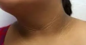 publive-image