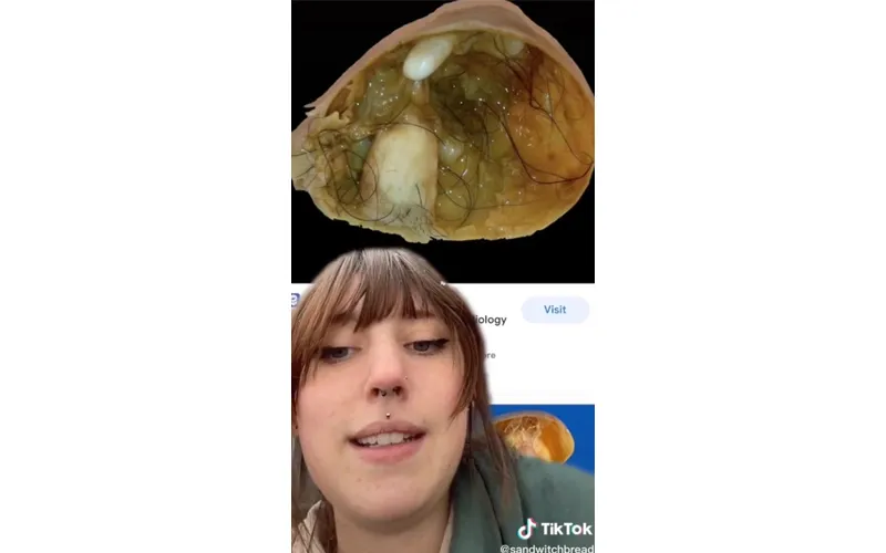 publive-image