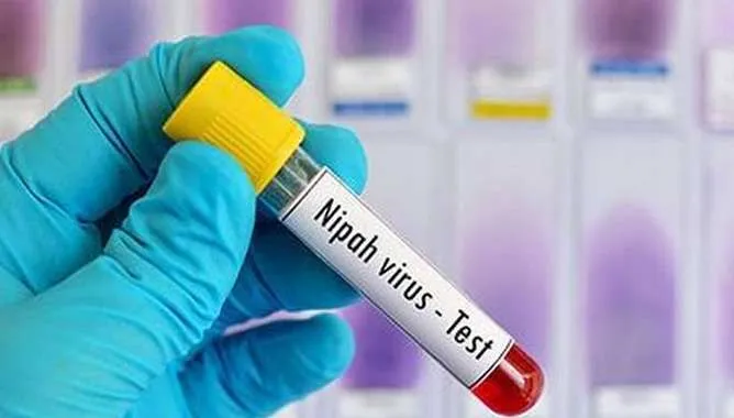 നിപ : രോഗ ലക്ഷണങ്ങളുമായി ഇതര സംസ്ഥാന തൊഴിലാളിയെ ആശുപത്രിയില്‍ പ്രവേശിച്ചു ; പുതുച്ചേരിയില്‍ നിരീക്ഷണത്തില്‍ കഴിയുന്നത് തിരൂരില്‍ ജോലി ചെയ്തിരുന്ന 79-കാരന്‍ 