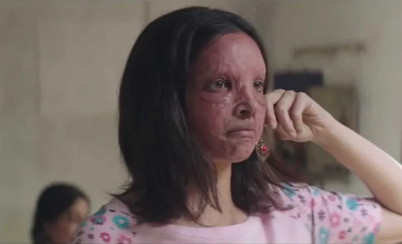 chhapaak trailer