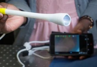 Indian-American Develops Handheld Device For Cervical Cancer Screening