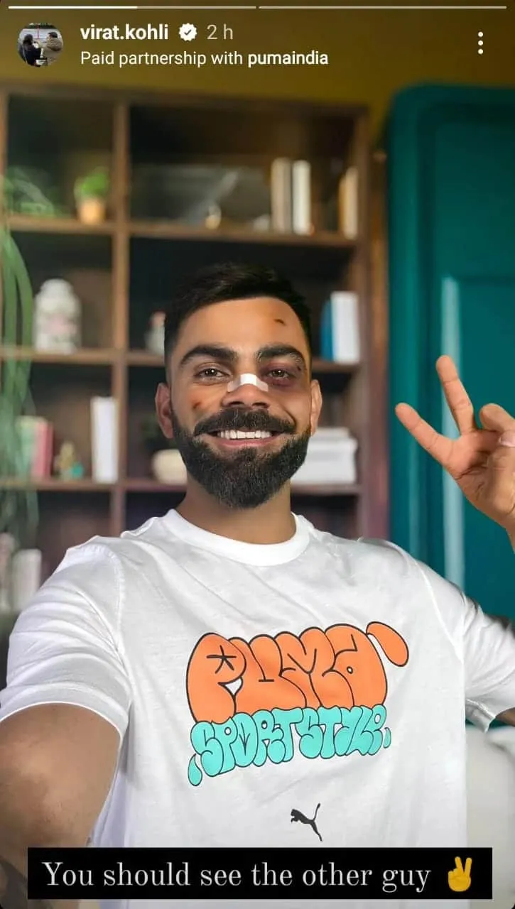 publive-image