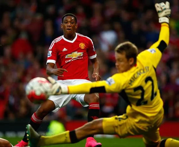 Anthony Martial shocked the world with his Man Utd strike | Sportz Point 