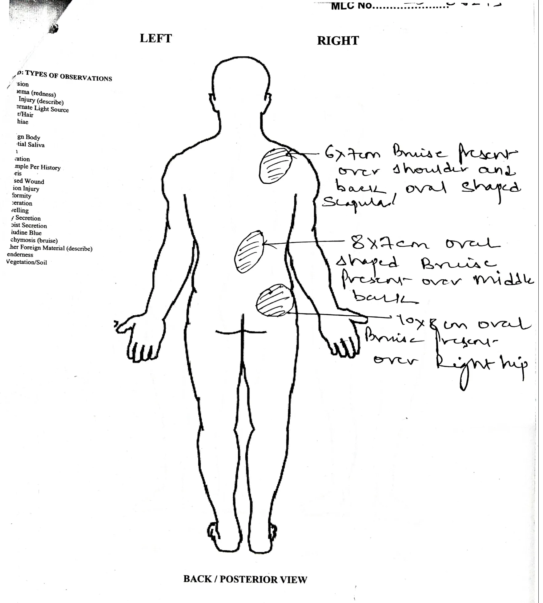 Medical report of rape victim 2