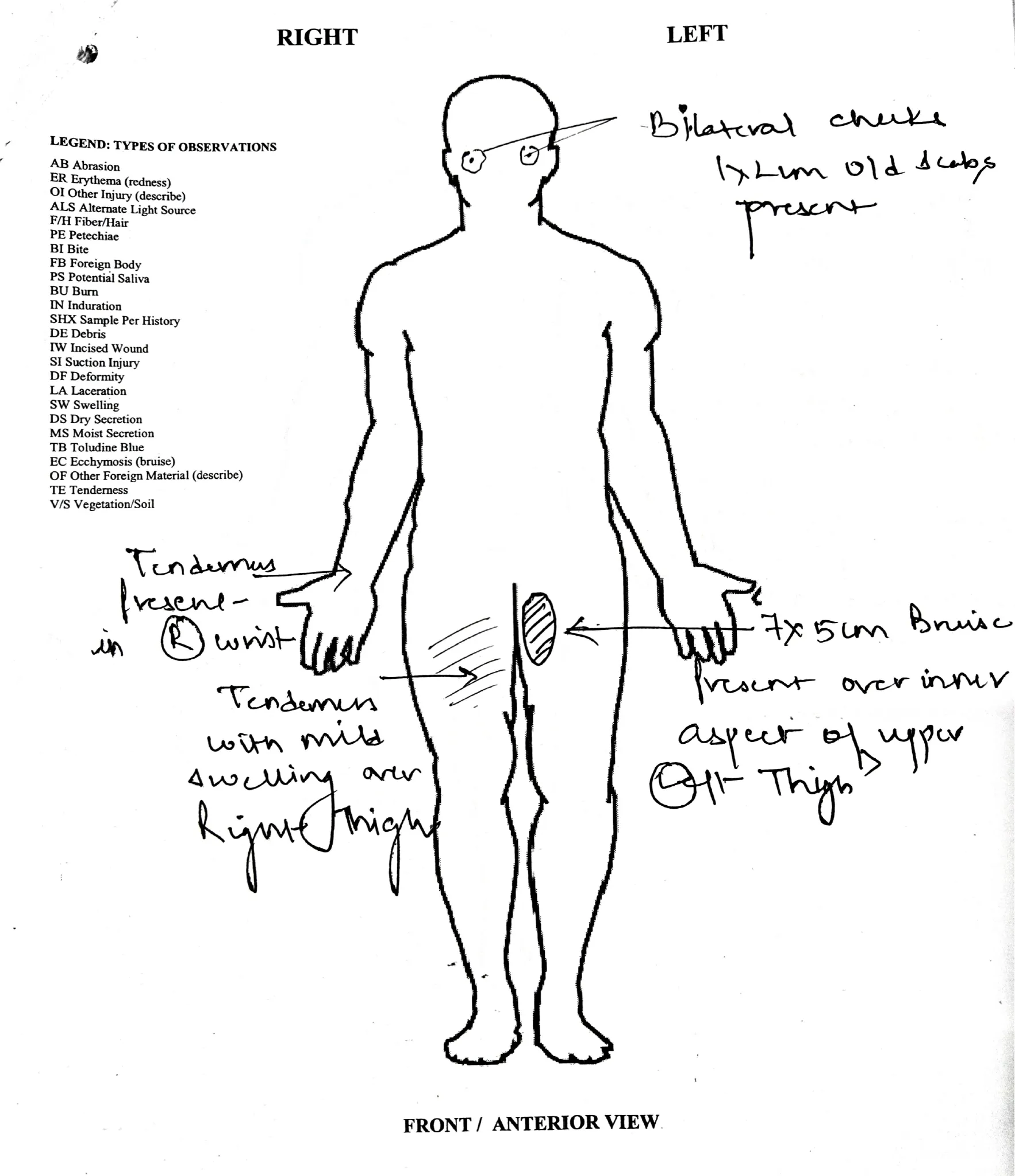 Medical report of rape victim 1