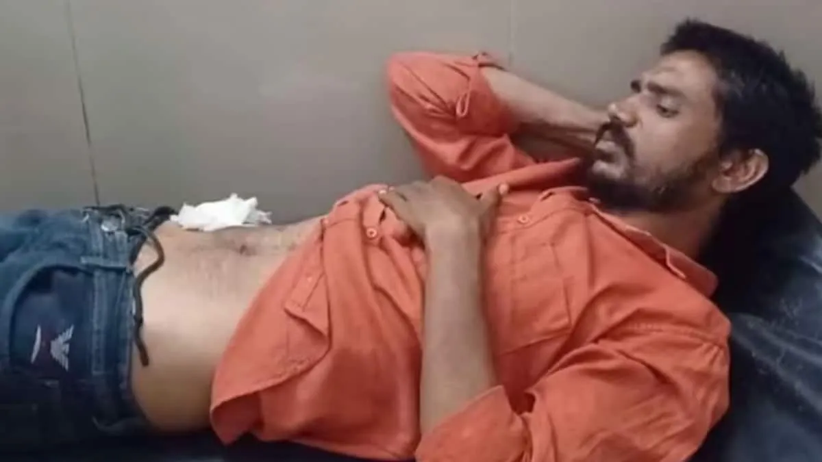 UP Man Performs Self-Surgery After Watching YouTube, Applies 11 Stitches -  News18