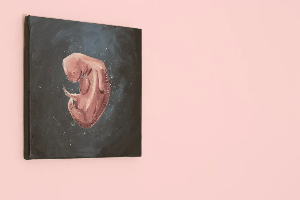 Abortion