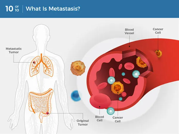 genetic risk of cancer