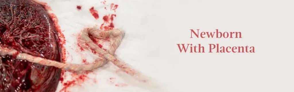  Newborn with placenta