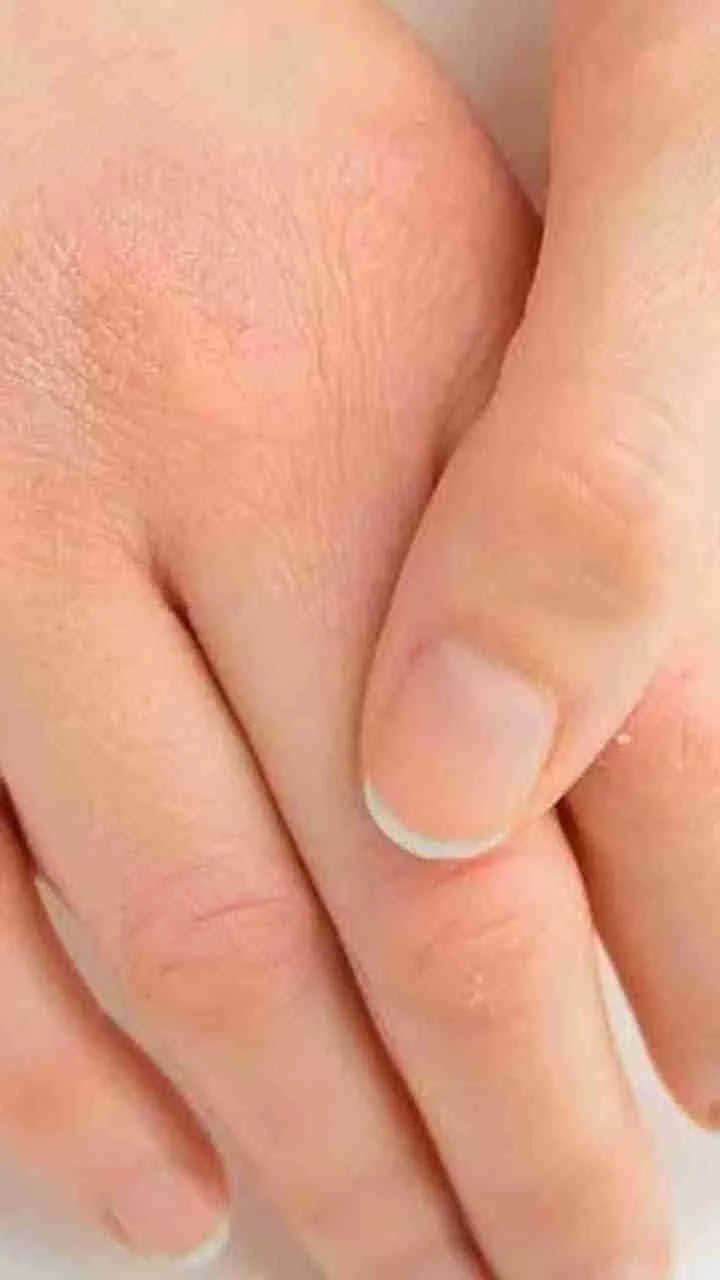 Discover the Importance of Nail Care for Seniors | EliteCare HC