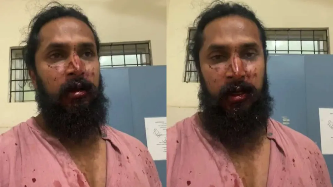 कन्नड़ अभिनेता चेतन चंद्रा भीड़ के हमले में घायल
