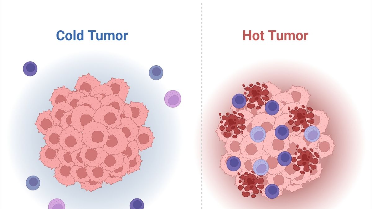 Breakthrough in Immunotherapy: 'Cold' Tumors Harbor Cancer-Fighting T ...