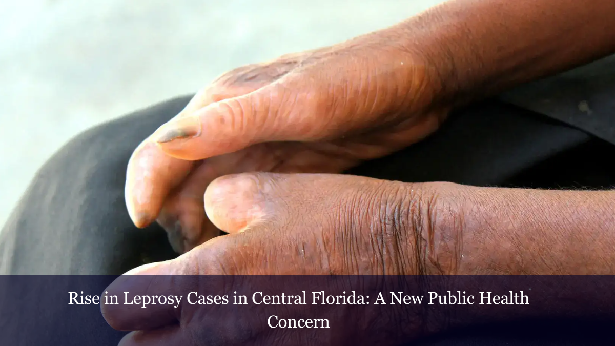 Rise in Leprosy Cases in Central Florida A New Public Health Concern