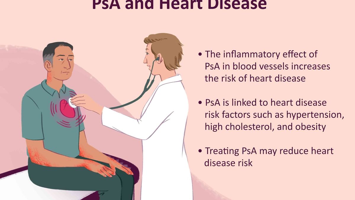 Psoriasis and Heart Disease Unveiling the Hidden Connection
