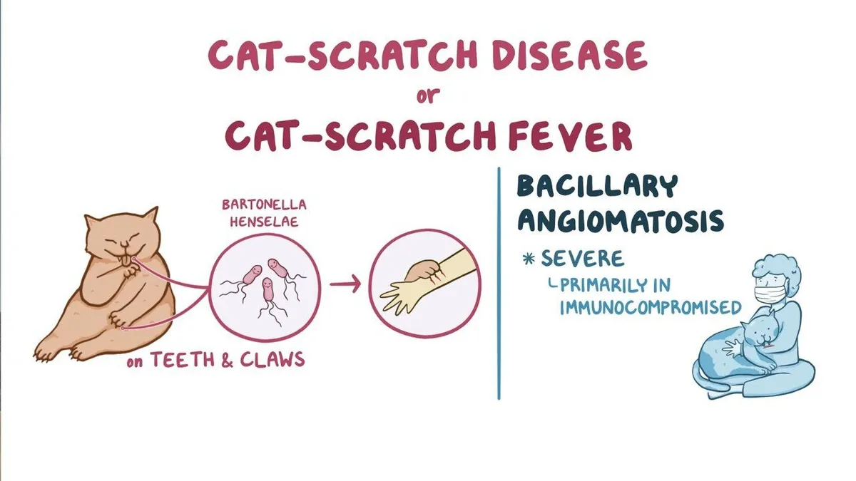 Cat scratch disease treatment cdc online