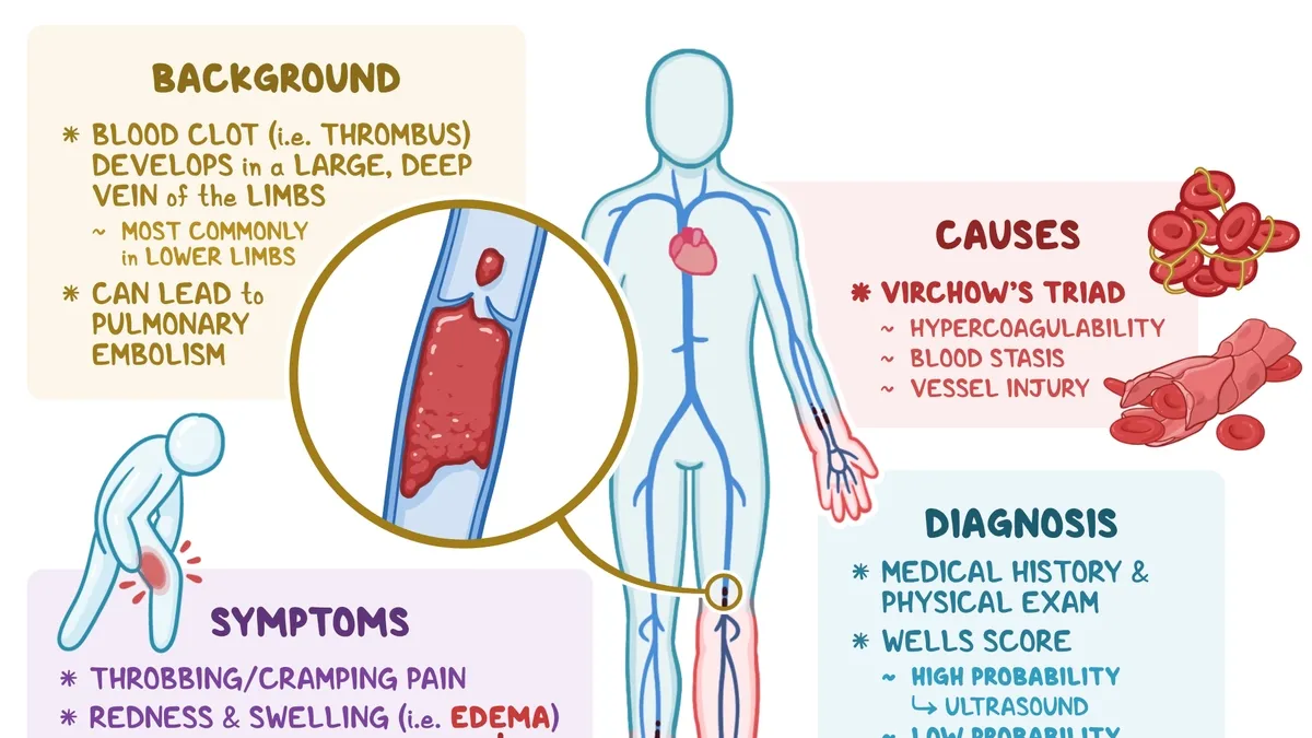 Understanding Blood Clots: Symptoms, Risks and Prevention