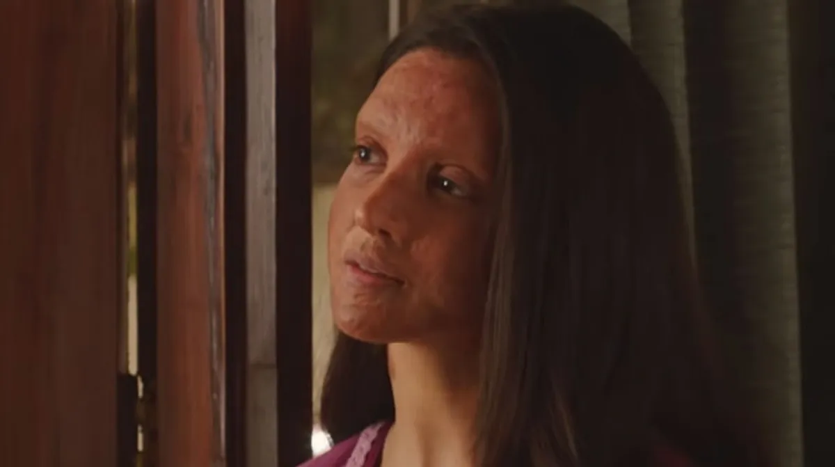 Chhapaak trailer: Watch Deepika Padukone's moving portrayal of an acid  attack survivor | Vogue India