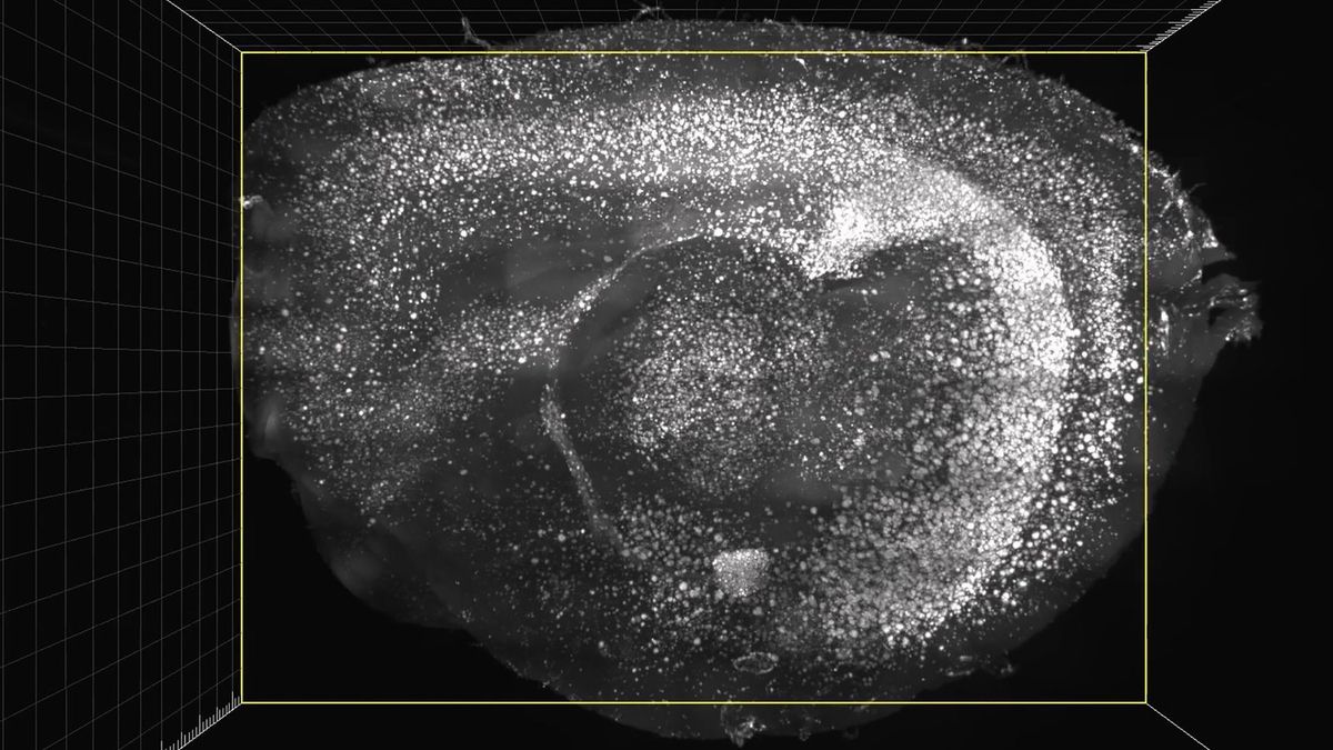 Revolutionizing Alzheimer's Treatment The Promise of 40Hz Light and