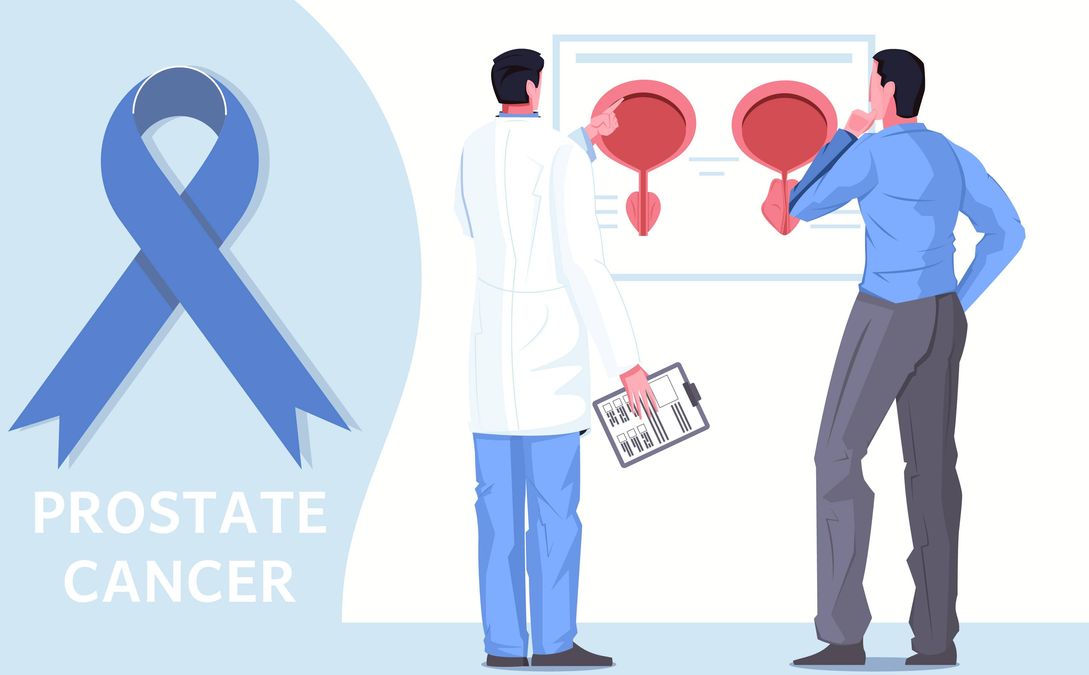 Understanding Prostate Cancer Risk Factors And Prevention 6693
