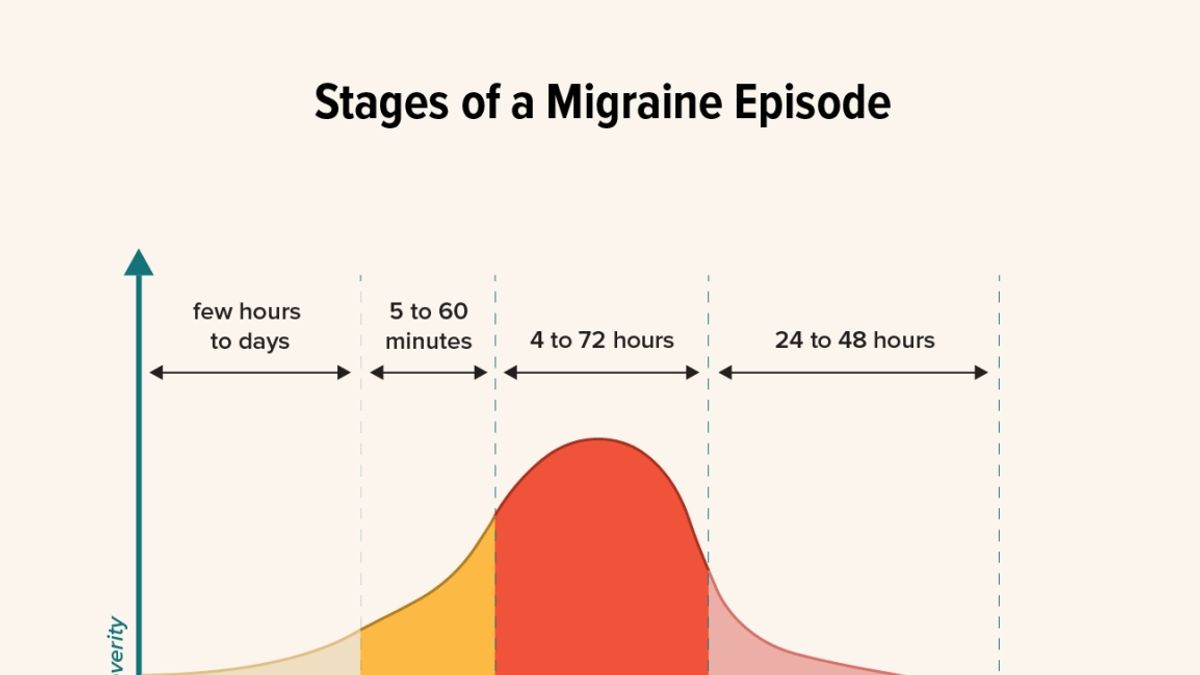 Revolutionizing Migraine Treatment: The Importance of the Prodromal Phase