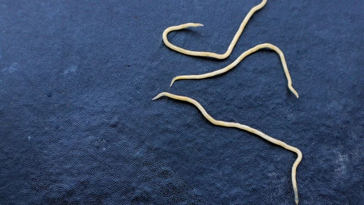 Understanding Pinworms (Threadworms): Causes, Symptoms, And Prevention Tips