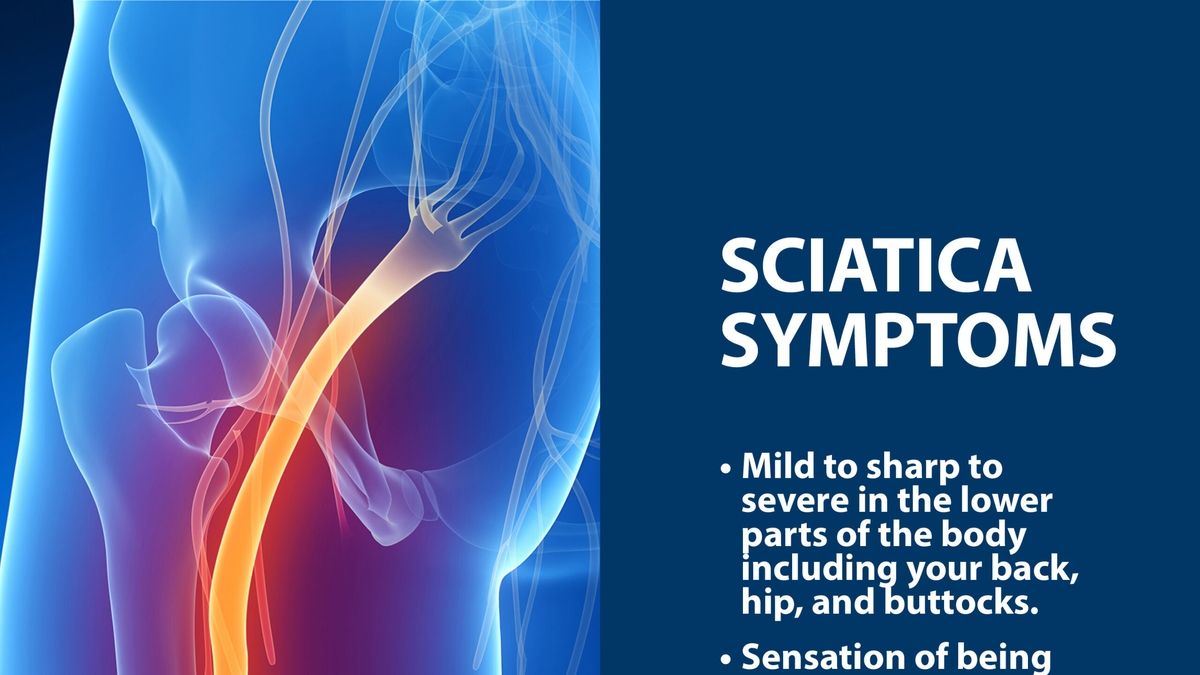 Understanding Sciatica: Causes, Symptoms and Treatment