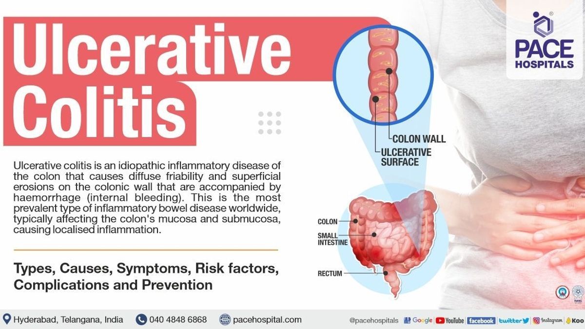 Understanding Ulcerative Colitis: Management, Quality of Life, and the ...